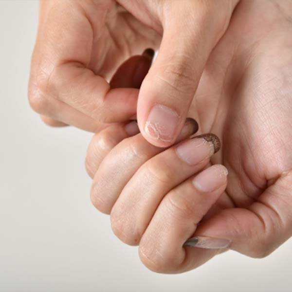 uñas descascarilladas