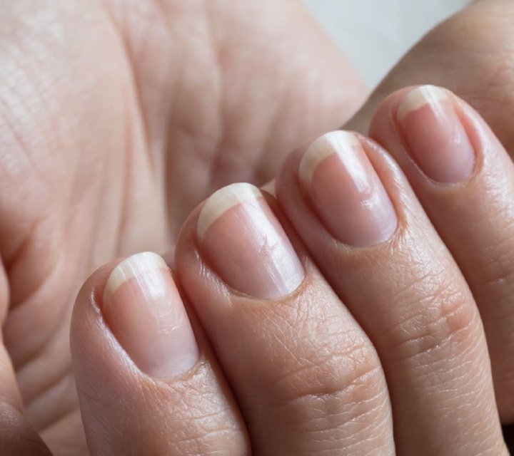 hoyitos en las uñas