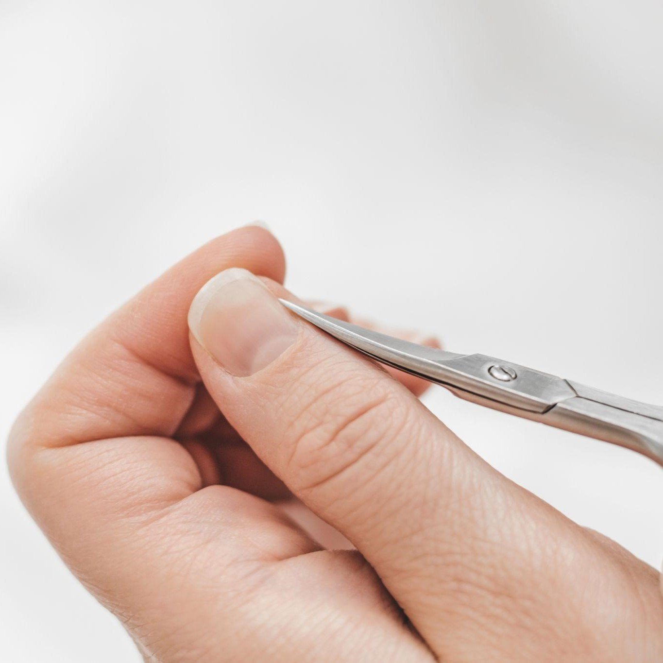 porque-salen-padrastros-en-los-dedos