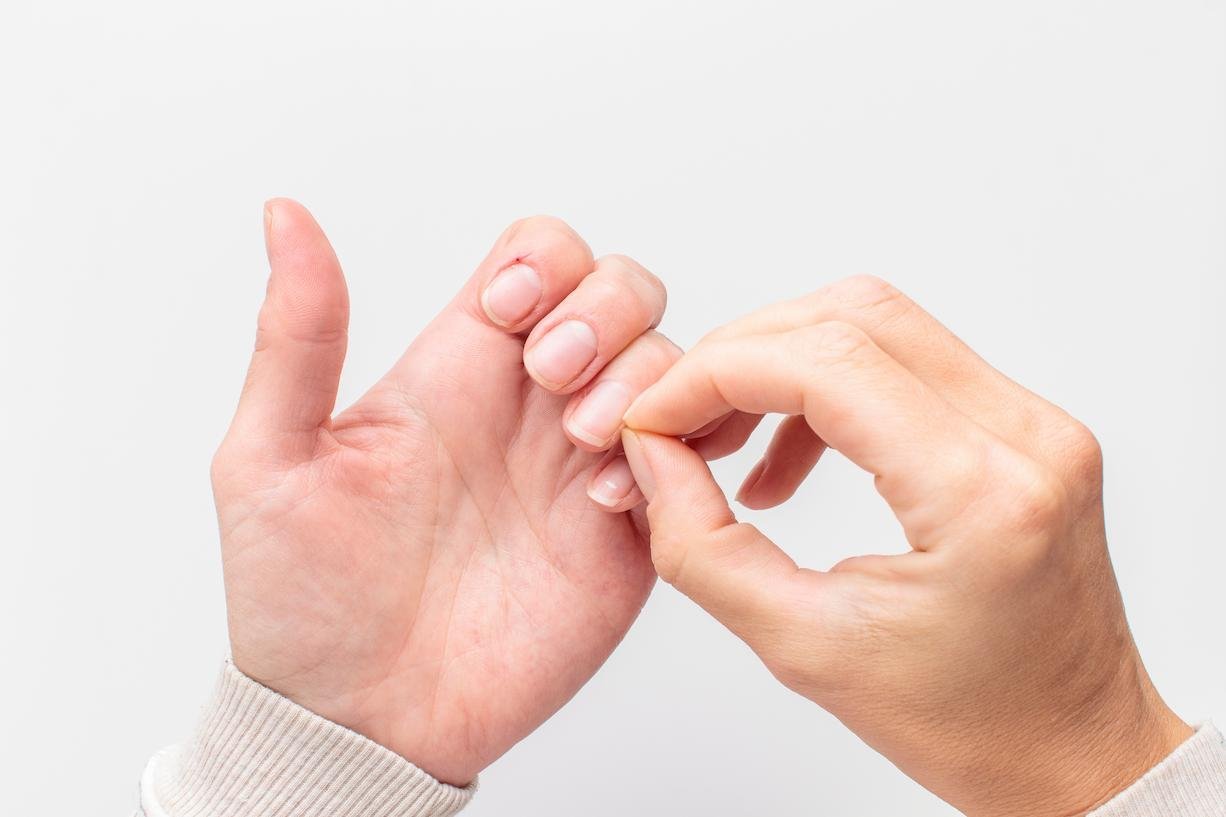 porque salen rayas en las uñas