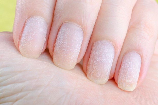 Uñas resecas